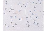 The image on the left is immunohistochemistry of paraffin-embedded Human brain tissue using CSB-PA070437(GATA4 Antibody) at dilution 1/20, on the right is treated with synthetic peptide. (Original magnification: 