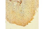 Immunohistochemistry of paraffin-embedded human tonsil tissue using CSB-PA07085A0Rb at dilution 1:100