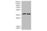 Western blot<br />
All lanes: FPR1 antibody at 6ug/ml<br />
Lane 1 : Colo320 whole cell lysate<br />
Lane 2 : HT29 whole cell lysate<br />
Secondary<br />
Goat polyclonal to Rabbit IgG at 1/10000 dilution<br />
Predicted band size: 38 kDa<br />
Observed b
