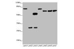 Western blot<br />
All lanes:Amyloid beta A4 antibody at 2.4ug/ml<br />
Lane 1: Mouse brain tissue<br />
Lane 2: Mouse kidney tissue<br />
Lane 3: Mouse lung tissue<br />
Lane 4: 293 whole cell lysate<br />
Lane 5: A549 whole cell lysate<br />
Lane 6:U251