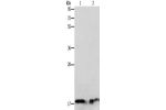 Gel: 12%SDS-PAGE, Lysate: 40 