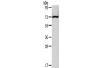 Gel: 6%SDS-PAGE,Lysate: 40 