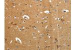 The image on the left is immunohistochemistry of paraffin-embedded Human brain tissue using CSB-PA074259(AMD1 Antibody) at dilution 1/40, on the right is treated with synthetic peptide. (Original magnification: 