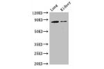 Western Blot<br />
Positive WB detected in:Mouse lung tissue,Mouse kidney tissue<br />
All lanes:CDH5 antibody at 3ug/ml<br />
Secondary<br />
Goat polyclonal to rabbit IgG at 1/50000 dilution<br />
Predicted band size: 88,75 kDa<br />
Observed band size:
