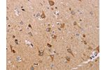 The image on the left is immunohistochemistry of paraffin-embedded Human brain tissue using CSB-PA075471(ATP5J Antibody) at dilution 1/15, on the right is treated with fusion protein. (Original magnification: 