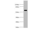 Western blot<br />
All lanes: Vitamin D-binding protein antibody at 2ug/ml+A549 whole cell lysate<br />
Secondary<br />
Goat polyclonal to rabbit at 1/10000 dilution<br />
Predicted band size: 53,40,56 kDa<br />
Observed band size: 53 kDa<br />
