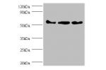 All lanes: Actin, cytoplasmic 1 antibody at 2ug/ml<br />
Lane 1: mouse spleen tissue<br />
Lane 2:293T whole cell lysate<br />
Lane 3:Hela whole cell lysate<br />
Secondary<br />
Goat polyclonal to Rabbit IgG at 1/10000 dilution<br />
Predicted band size: