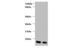 Western blot<br />
All lanes: FABP3 Antibody at dilution of 1:1000<br />
Lane 1 : Rat heart tissue<br />
Lane 2 : Mouse heart tissue<br />
Secondary<br />
Goat polyclonal to Rabbit IgG at 1/15000 dilution<br />
Predicted band size: 15 kDa<br />
Observed b