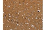 The image on the left is immunohistochemistry of paraffin-embedded Human brain tissue using CSB-PA077659(CSH1 Antibody) at dilution 1/40, on the right is treated with fusion protein. (Original magnification: 