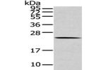 Gel: 12%SDS-PAGE,Lysate: 40 