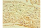 Immunohistochemistry of paraffin-embedded human heart tissue using CSB-PA07957A0Rb at dilution 1:100