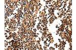 The image on the left is immunohistochemistry of paraffin-embedded Human tonsil tissue using CSB-PA079625(FOXB2 Antibody) at dilution 1/5, on the right is treated with synthetic peptide. (Original magnification: 