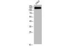 Western Blot analysis of COLO cells using CEP135 Polyclonal Antibody