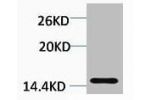 Western blot analysis of Hela, diluted at 1:1000.