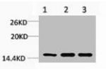 Western blot analysis of 1) Hela, 2) 3T3, 3) Rat Liver Tissue, diluted at 1:1000.