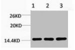 Western blot analysis of 1) Hela, 2) 3T3, 3) Rat Liver Tissue, diluted at 1:1000.
