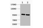 Western blot analysis of 1) 3T3, 2) Rat Liver, diluted at 1:2,000.