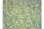 Immunohistochemical analysis of paraffin-embedded Mouse Liver Tissue using EPG5 Polyclonal Antibody.