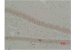 Immunohistochemical analysis of paraffin-embedded Rat Brain Tissue using BEST2 Polyclonal Antibody.