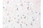 The image on the left is immunohistochemistry of paraffin-embedded Human brain tissue using CSB-PA083230(ADAM20 Antibody) at dilution 1/30, on the right is treated with fusion protein. (Original magnification: 