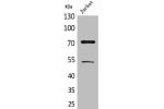 Western Blot analysis of Jurkat cells using Acetyl-Ku-70 (K539) Polyclonal Antibody
