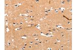 The image on the left is immunohistochemistry of paraffin-embedded Human brain tissue using CSB-PA085715(CHRNA3 Antibody) at dilution 1/30, on the right is treated with synthetic peptide. (Original magnification: 