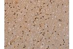 The image is immunohistochemistry of paraffin-embedded Human brain tissue using CSB-PA087396(GADD45A Antibody) at dilution 1/30. (Original magnification: 