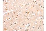 The image on the left is immunohistochemistry of paraffin-embedded Human brain tissue using CSB-PA087998(CIDEC Antibody) at dilution 1/30, on the right is treated with fusion protein. (Original magnification: 