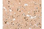 The image on the left is immunohistochemistry of paraffin-embedded Human brain tissue using CSB-PA088085(ELOVL6 Antibody) at dilution 1/25, on the right is treated with synthetic peptide. (Original magnification: 
