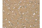 The image on the left is immunohistochemistry of paraffin-embedded Human brain tissue using CSB-PA088870(ATP2A3 Antibody) at dilution 1/30, on the right is treated with synthetic peptide. (Original magnification: 