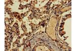 Immunohistochemistry of paraffin-embedded human lung tissue using CSB-PA08939A0Rb at dilution of 1:100