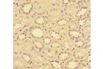 Immunohistochemistry of paraffin-embedded human kidney tissue using CSB-PA08947A0Rb at dilution of 1:100