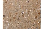The image on the left is immunohistochemistry of paraffin-embedded Human brain tissue using CSB-PA090550(COX6B2 Antibody) at dilution 1/50, on the right is treated with fusion protein. (Original magnification: 