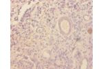 Immunohistochemistry of paraffin-embedded human kidney using CSB-PA09069A0Rb at dilution 1:100
