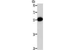 Gel: 10%SDS-PAGE, Lysate: 40 