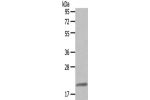 Gel: 10%SDS-PAGE,Lysate: 40 