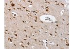 The image on the left is immunohistochemistry of paraffin-embedded Human brain tissue using CSB-PA092272(CTSL Antibody) at dilution 1/40, on the right is treated with fusion protein. (Original magnification: 