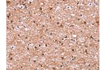The image on the left is immunohistochemistry of paraffin-embedded Human brain tissue using CSB-PA093138(ADM2 Antibody) at dilution 1/40, on the right is treated with synthetic peptide. (Original magnification: 