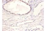 Immunohistochemistry of paraffin-embeded human prostate using CSB-PA09419A0Rb at dilution of 1:100
