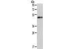 Gel: 8%SDS-PAGE,Lysate: 40 