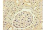 Immunohistochemistry of paraffin-embedded human kidney tissue using CSB-PA09689A0Rb at dilution of 1:100