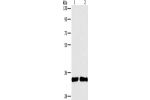 Gel: 8%SDS-PAGE, Lysate: 40 