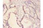 Immunohistochemistry of paraffin-embedded human prostate using CSB-PA09759A0Rb at dilution of 1:100