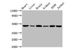 Western blot<br />
All lanes: ENO2antibody at 1.5ug/ml<br />
Lane 1 : Mouse heart tissue<br />
Lane 2 : Mouse liver tissue<br />
Lane 3 : Mouse brain tissue<br />
Lane 4 : Mouse kidney tissue<br />
Lane 5 : A549 whole cell lysate<br />
Lane 6 : Jurkat who