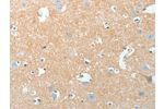 The image on the left is immunohistochemistry of paraffin-embedded Human brain tissue using CSB-PA097902(AKAP7 Antibody) at dilution 1/15, on the right is treated with fusion protein. (Original magnification: 