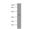 All lanes: Creatine kinase M-type antibody at 2ug/ml+293T whole cell lysate<br />
Secondary<br />
Goat polyclonal to Rabbit IgG at 1/10000 dilution<br />
Predicted band size: 42 kDa<br />
Observed band size: 42 kDa<br />