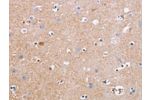 The image on the left is immunohistochemistry of paraffin-embedded Human brain tissue using CSB-PA099386(CDC7 Antibody) at dilution 1/50, on the right is treated with synthetic peptide. (Original magnification: 