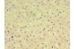 Immunohistochemistry of paraffin-embedded human liver tissue using CSB-PA09987A0Rb at dilution 1:100