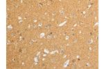 The image on the left is immunohistochemistry of paraffin-embedded Human brain tissue using CSB-PA100516(ATP1A1 Antibody) at dilution 1/15, on the right is treated with synthetic peptide. (Original magnification: 