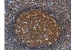 The image on the left is immunohistochemistry of paraffin-embedded Human tonsil tissue using CSB-PA101118(GNA13 Antibody) at dilution 1/30, on the right is treated with fusion protein. (Original magnification: 